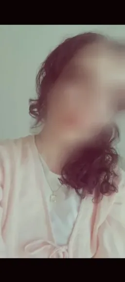 Naja, 27